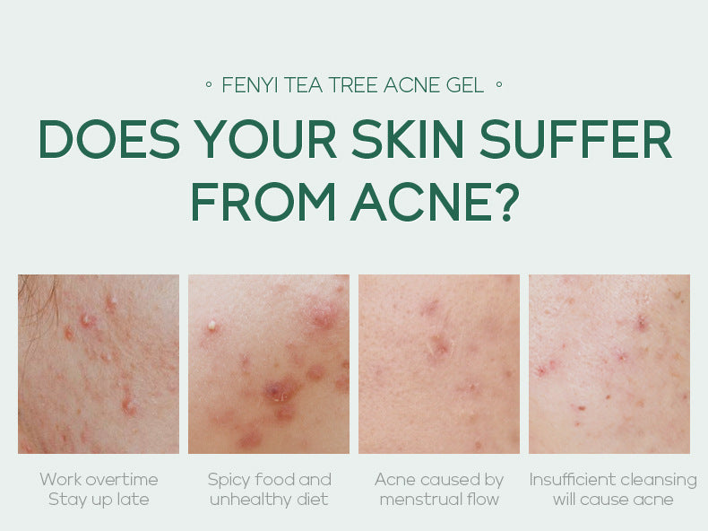 🌿 Lalubel™ Tea Tree Acne Repairing Gel - LALUBEL LLC