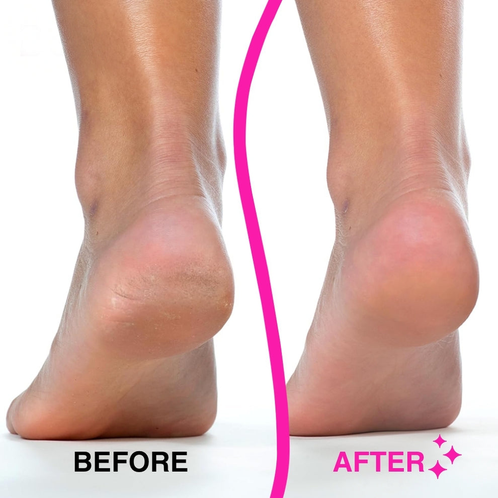 Electric Foot Grinder Foot Peeling Machine Foot Repair Tool