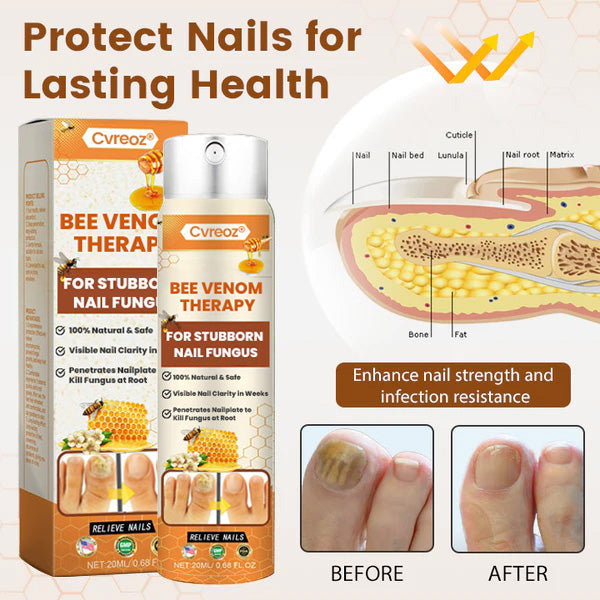 Grey Nail Treatment Spray