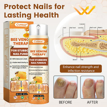 Grey Nail Treatment Spray