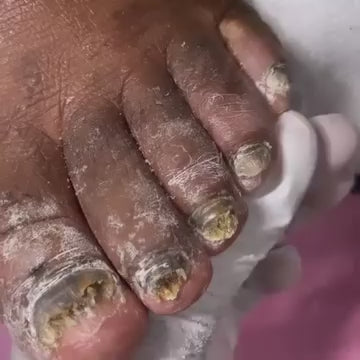Grey Nail Treatment Spray
